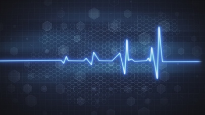 4K心跳心电图光线2